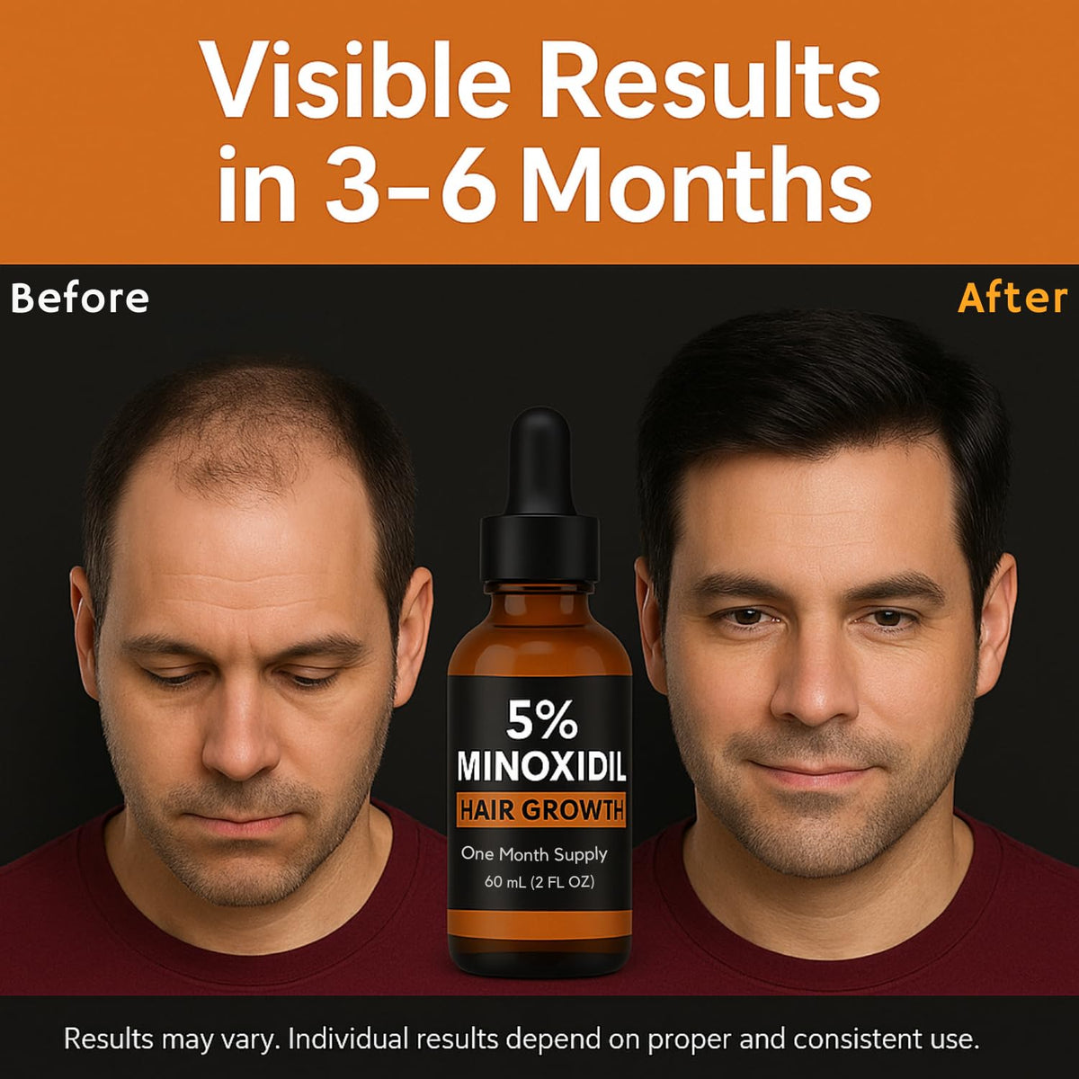 5% Minoxidil Hair Growth Serum for Men – Extra Strength Scalp Treatment