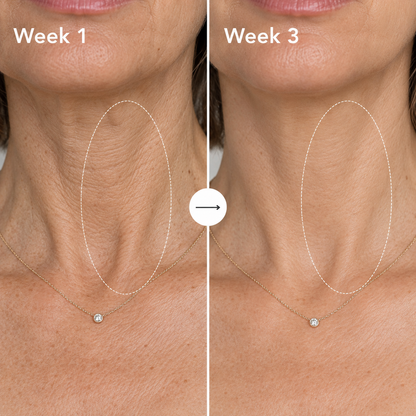 Neck Firming Cream – Tightening & Lifting Moisturizer for Neck, Face