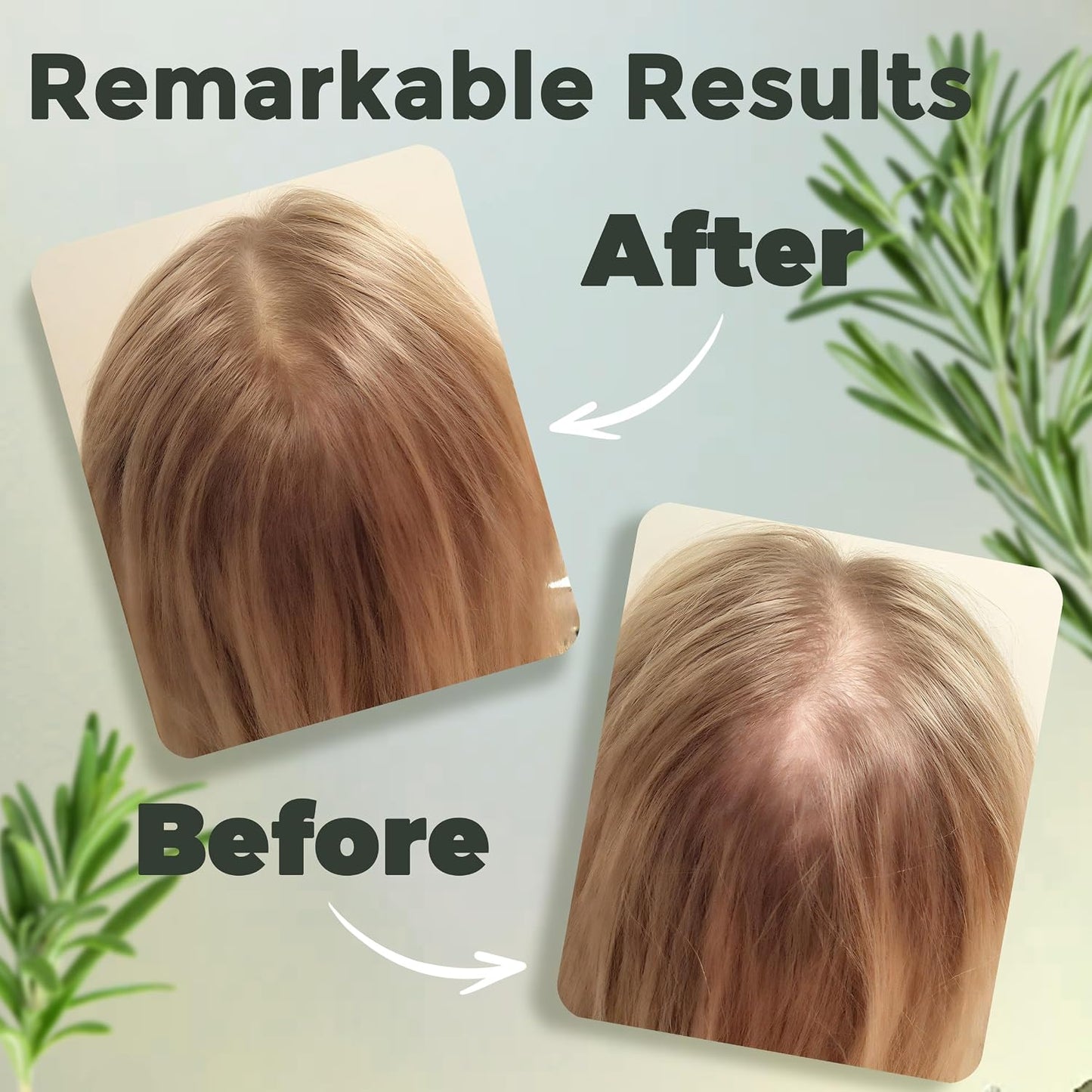 Rosemary Hair Oil with Biotin, Castor & Jojoba Oil for Scalp Care and Fuller-Looking Hair