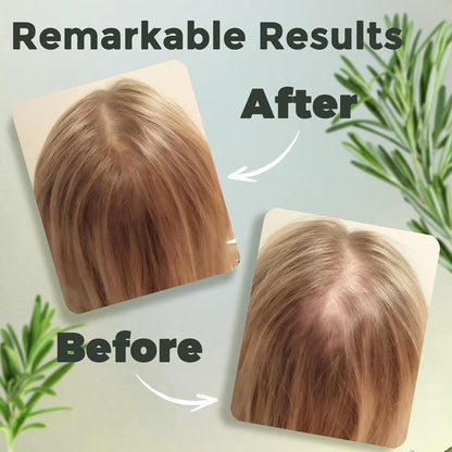 Rosemary Hair Oil with Biotin, Castor & Jojoba Oil for Scalp Care and Fuller-Looking Hair